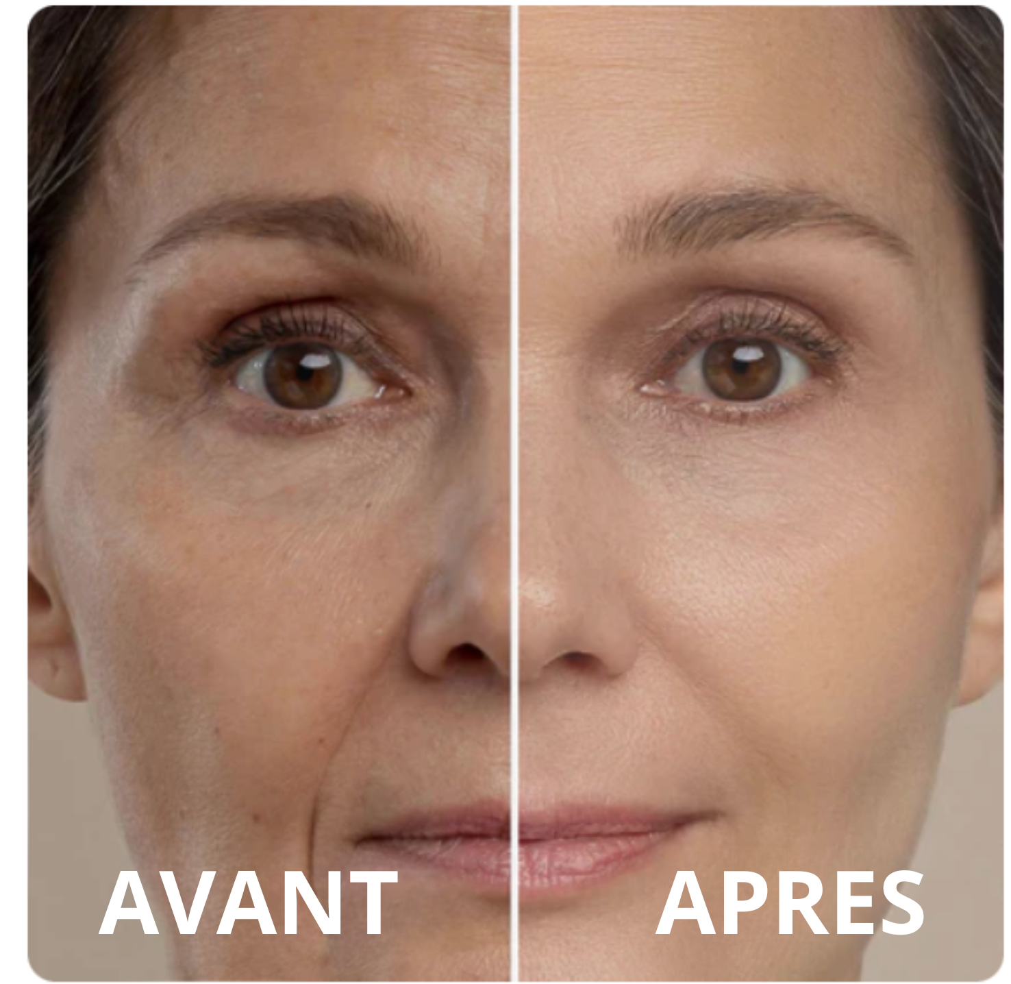 SKINESIS® | Soin anti-âge et liftant